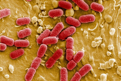 Ehec-bacterie onder de microscoop. - foto: ANP